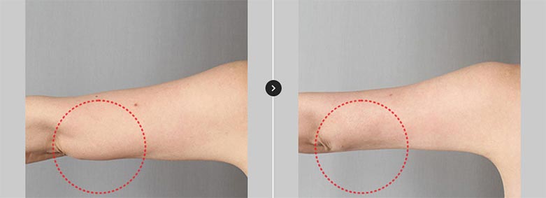 커스터마이징 솔루션