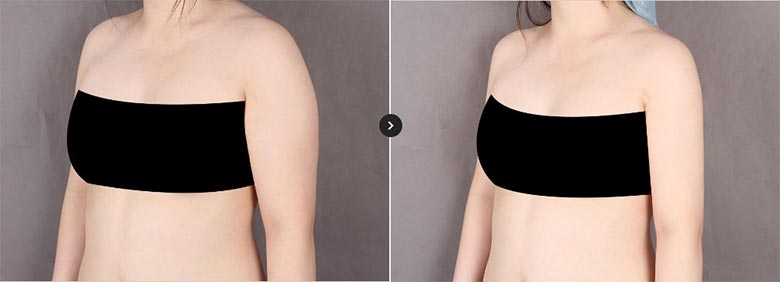 커스터마이징 솔루션