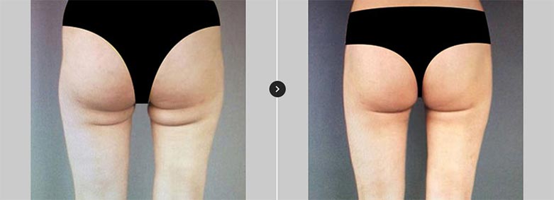 커스터마이징 솔루션