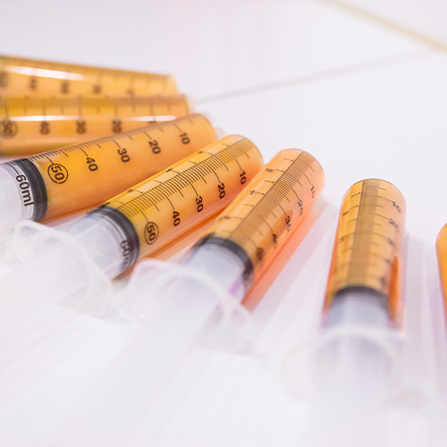 Syringes filled with fat after a liposuction procedure, representing the precision and effectiveness of body contouring treatments at 365MC Clinic
