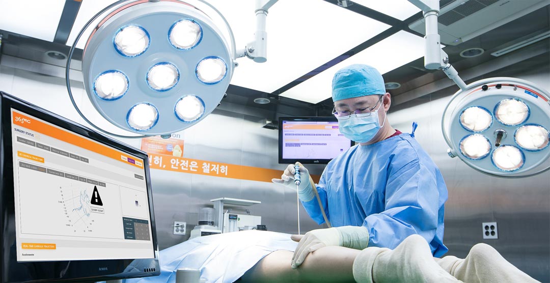 A surgeon performing a procedure in an operating room, using advanced medical technology displayed on a monitor.