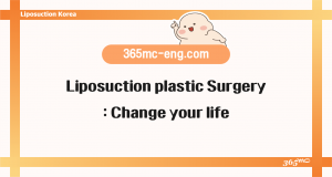 Liposuction plastic Surgery: Change your life