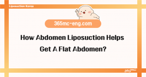 How Abdomen Liposuction Helps Get A Flat Abdomen