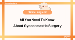 All You Need To Know About Gynecomastia Surgery