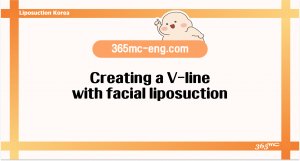 Creating a V-line with facial liposuction