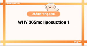 WHY 365mc liposuction 1