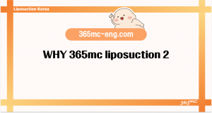 WHY 365mc liposuction 2