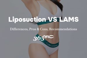20240104-Title-Image-scaled.jpg Liposuction vs. LAMS comparison for body contouring.