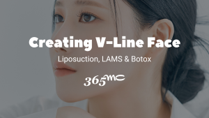 20240425-Title-Image Creating a V-Line face with liposuction, LAMS, and Botox at 365mc.
