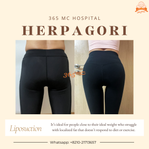 Herpagori Before After