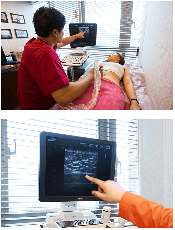 365mc doctor performing an ultrasound examination to analyze fat layer thickness and distribution