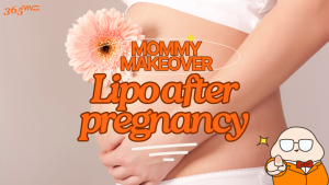 Mommy Makeover: Liposuction After Pregnancy