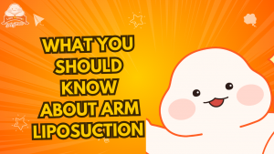 What You Should Know About Arm Liposuction thumbnail image for 365mc blog